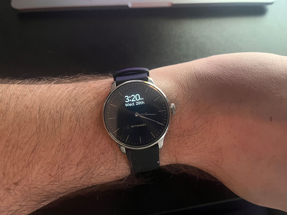 Withings ScanWatch Review (2024): A Worthy Opponent of the Top Smartwatch Brands Cover Image